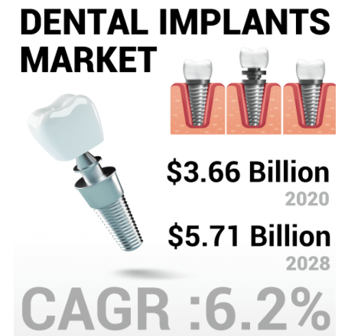 Dental Implants Market to Reach a Value of US$ 5,725.7