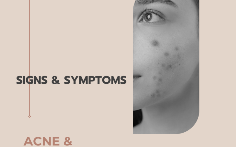 Acne and Allergies: Understanding the Connection
